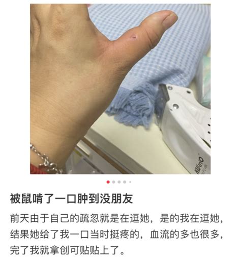 夢到被老鼠咬手|梦见被老鼠咬手